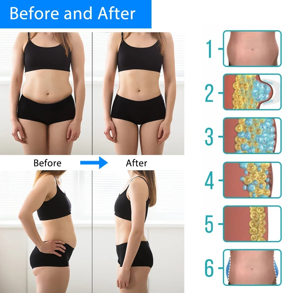 Adrinalin Anti-Cellulite- und Körperstraffungsmassagegerät